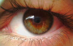 Цистицеркоз глаз человека: лечение и профилактика