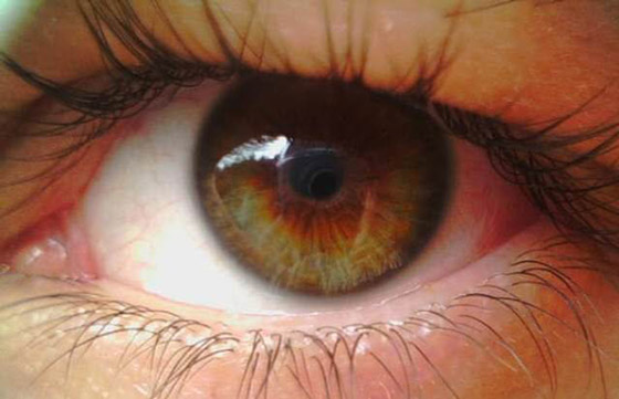 глаз человека